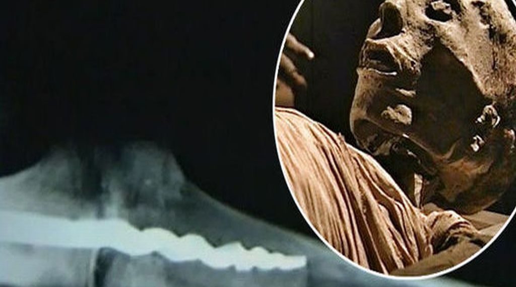7-obiective-misterioase-de-pe-pamant-surubul-ortopedic-de-23-de-centimetri-descoperit-la-o-mumie-egipteana