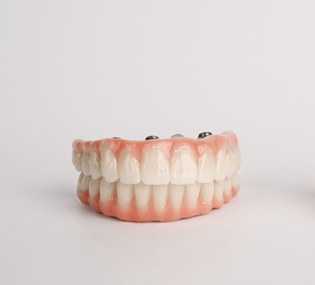De ce difera preturile pentru tratamentele dentare